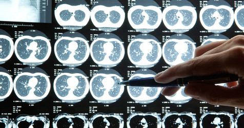 featured image of blog