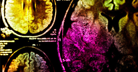 featured image of blog