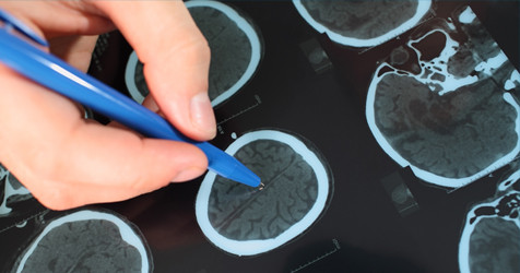 featured image of blog