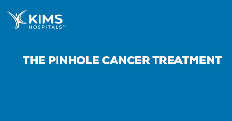 featured image of blog