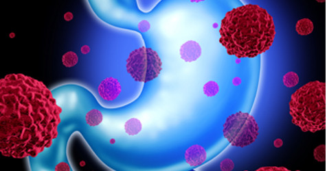 featured image of blog