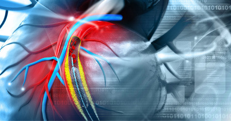 featured image of blog