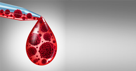 featured image of blog