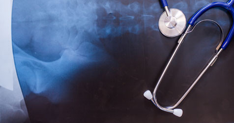 featured image of blog