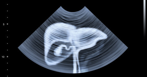 featured image of blog