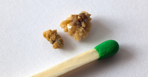 featured image of blog