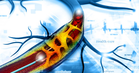 featured image of blog