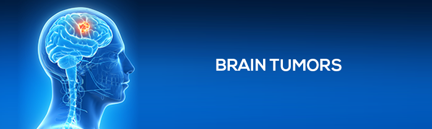 featured image of blog