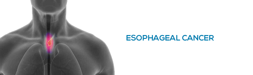 featured image of blog