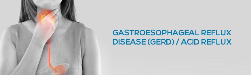 featured image of blog